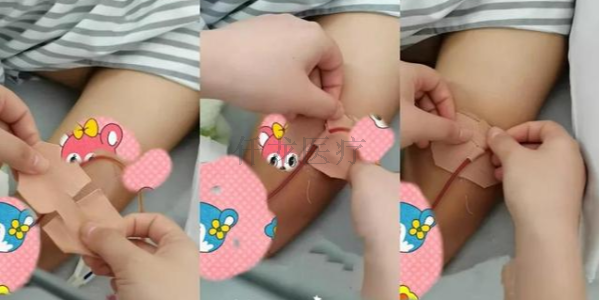 巧用3M宜拉膠帶制作導管固定貼