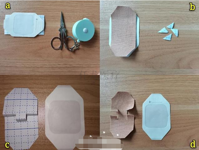 巧用3M宜拉膠帶制作導(dǎo)管固定貼