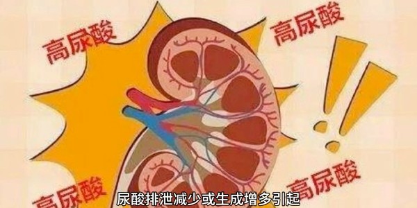 別等痛風(fēng)才后悔：揭秘高尿酸血癥的“靜默殺機(jī)”